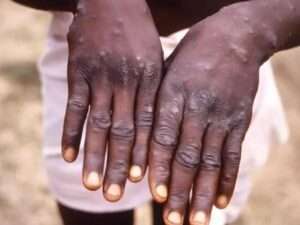 WhatsApp Image 2024-08-20 at 12.36.10